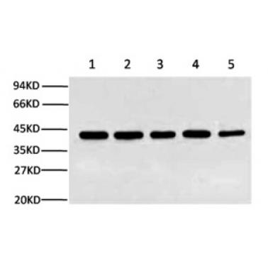 蛋白质免疫印迹(Western Blot,WB )技术服务