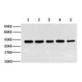 蛋白质免疫印迹(Western Blot,WB )技术服务