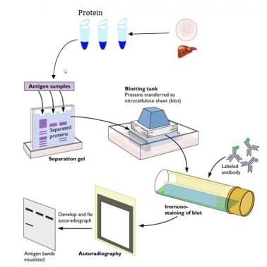 免疫蛋白印迹（WB,Western Blot）技术服务